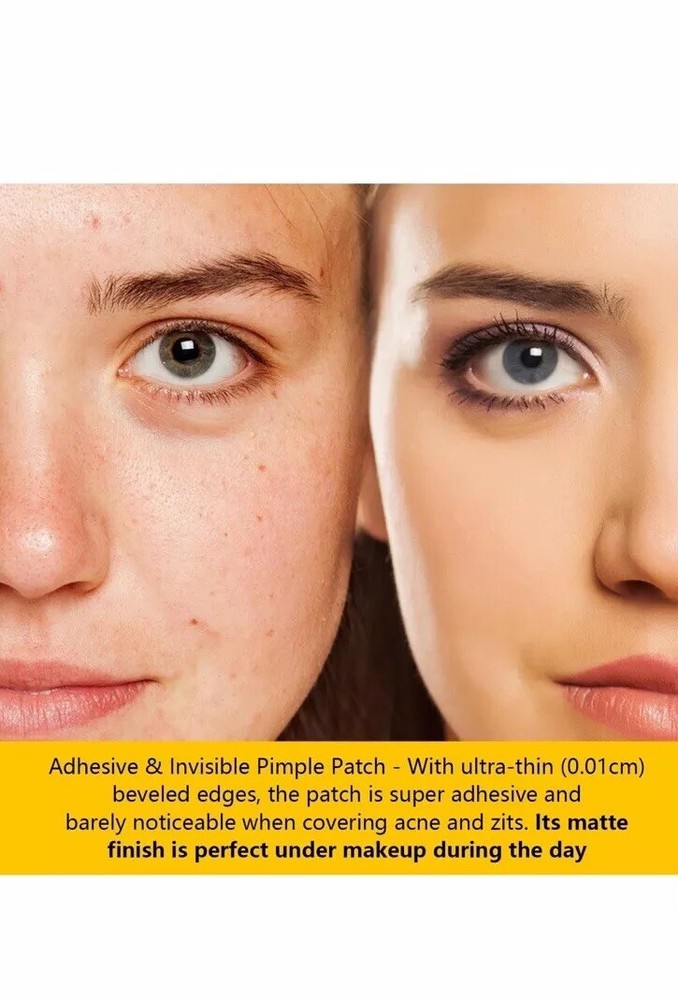 Silky Sense Beveled Acne Patches