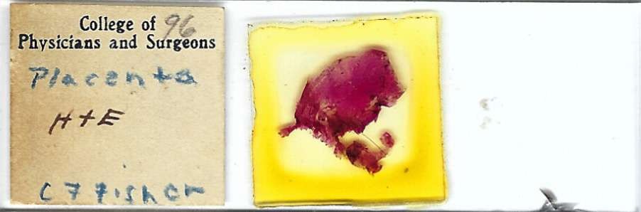 Human Placenta Microscope Slide