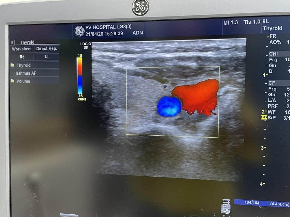 Ge ultrasound probe Linear 9L-D