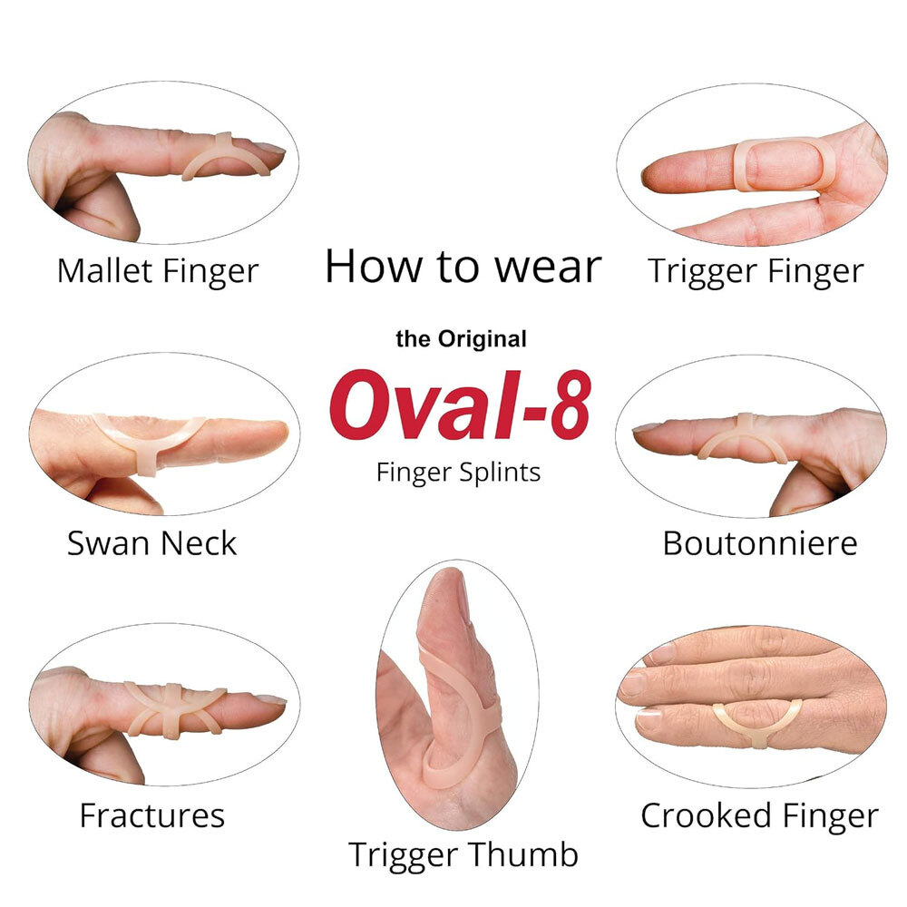 3pp Oval-8 Finger Splint
