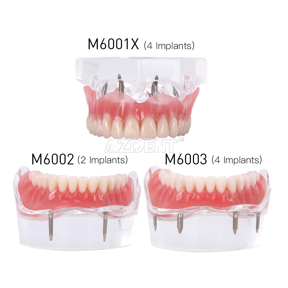 Dental Oral Study Teach Standard Typodont Tissue Decomposition Teaching Model