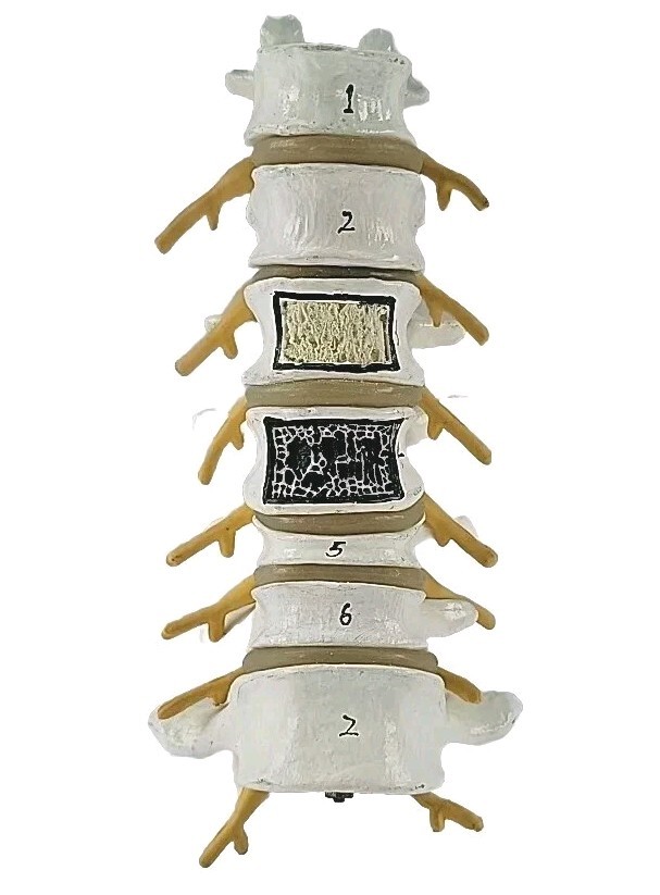 Lumbar Vertebral Spine Model Human Lumbar Educational Teaching Tool 8"
