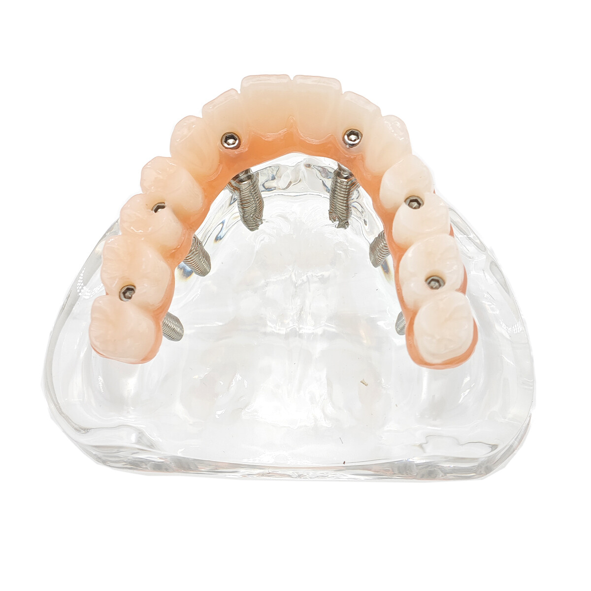 Dental Upper/Lower 4/6 Implants Demo Implant Teeth Model Restoration Overdenture