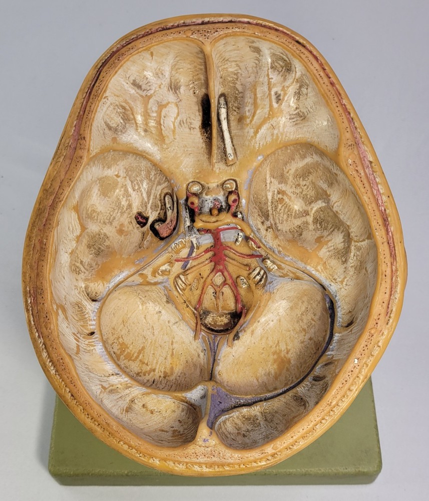 Vintage Somso Anatomical BS5 Head Base & Brain Model - Germany - INCOMPLETE