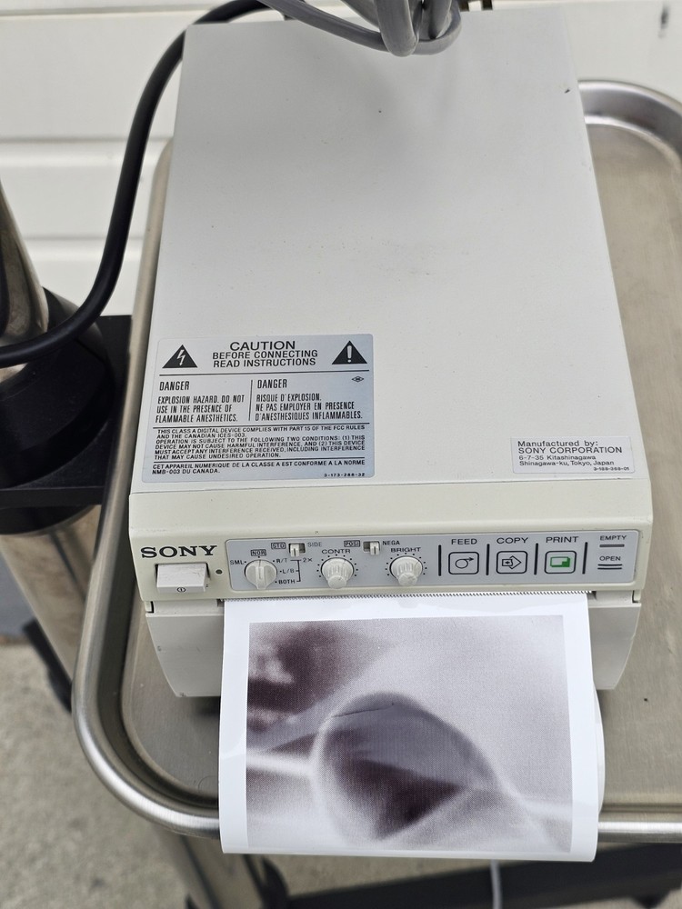 Wallach Zoomscope Colposcope System Nikon 164234 W/ Printer & Camera Control