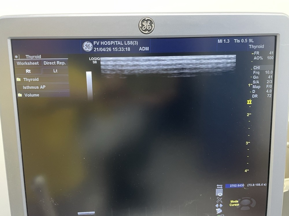 Ge ultrasound probe Linear 9L-D