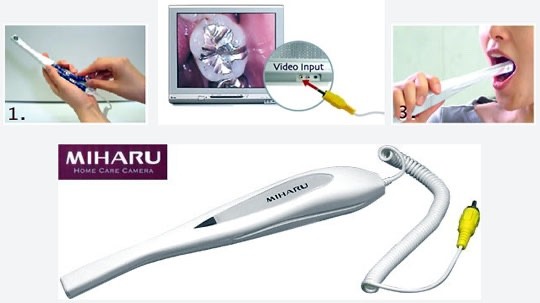 Miharu - Dental Intraoral Plaque Detection Camera Oral hygiene cleaning - RCA
