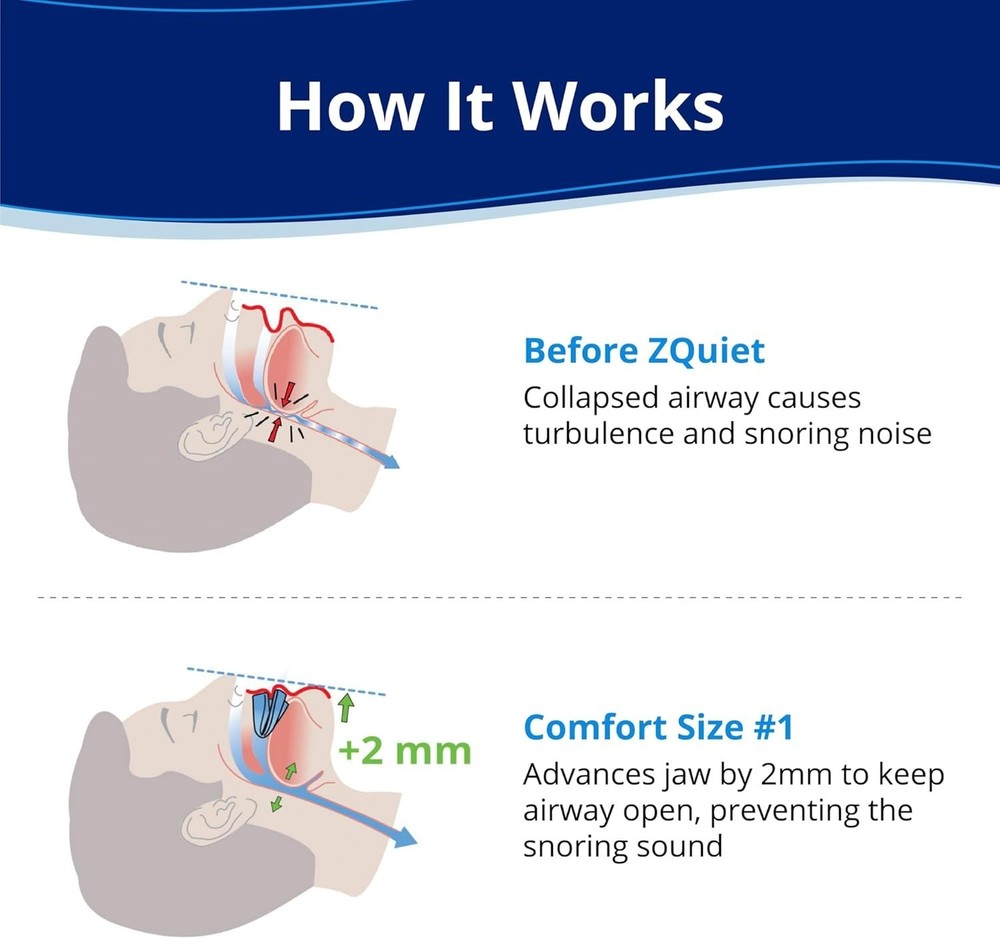 Anti-Snoring Mouthpiece Single Refill