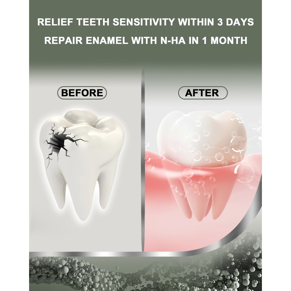 MySmile Nano Hydroxyapatite Toothpaste Fluoride Free Sensitive Relief Mint 4.2oz