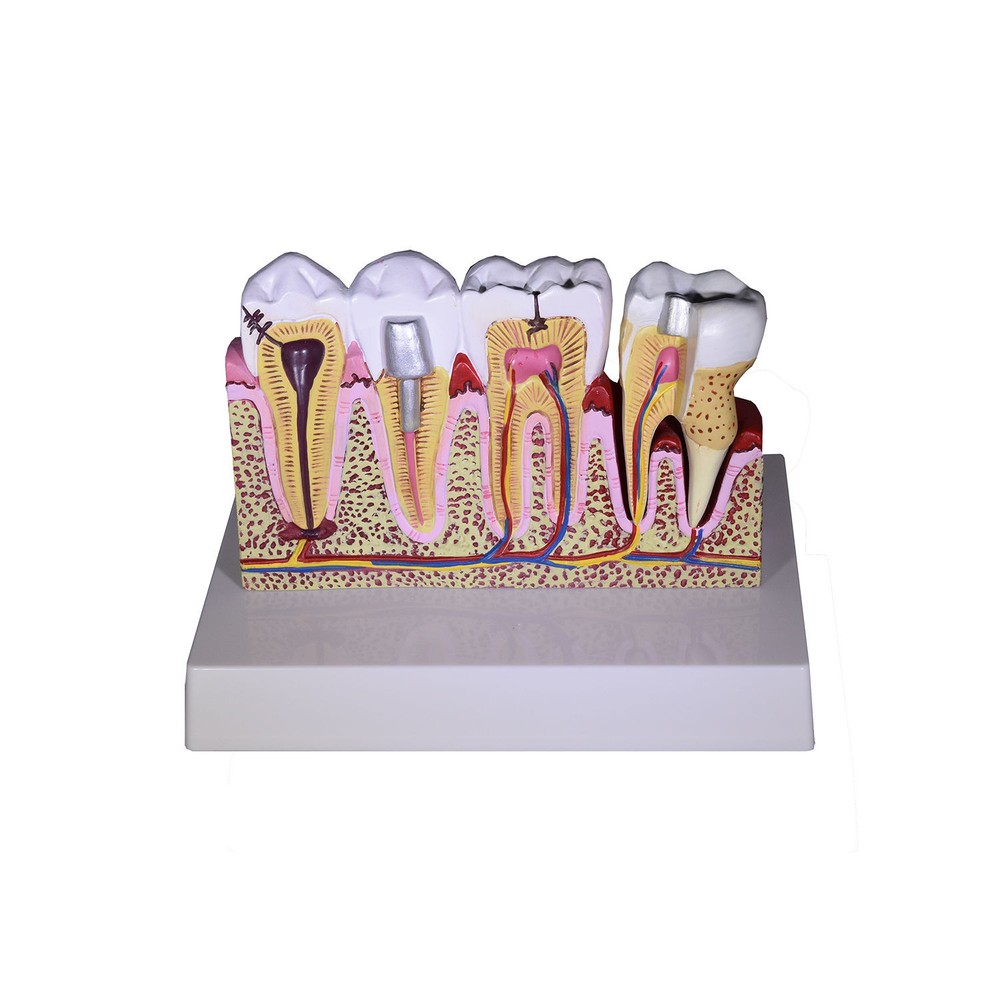 Redland Dental Demonstration Teeth Educational Model -3339 Model 4