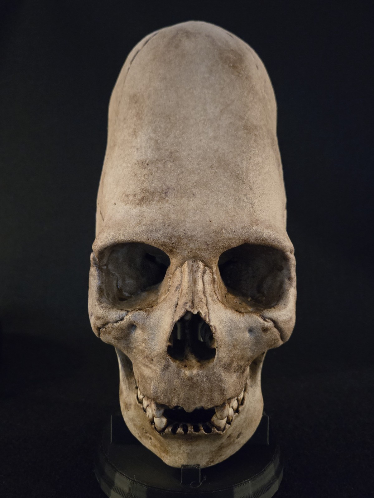Human Skull - Peruvian Enlongated- Hyper Realistic with stand.