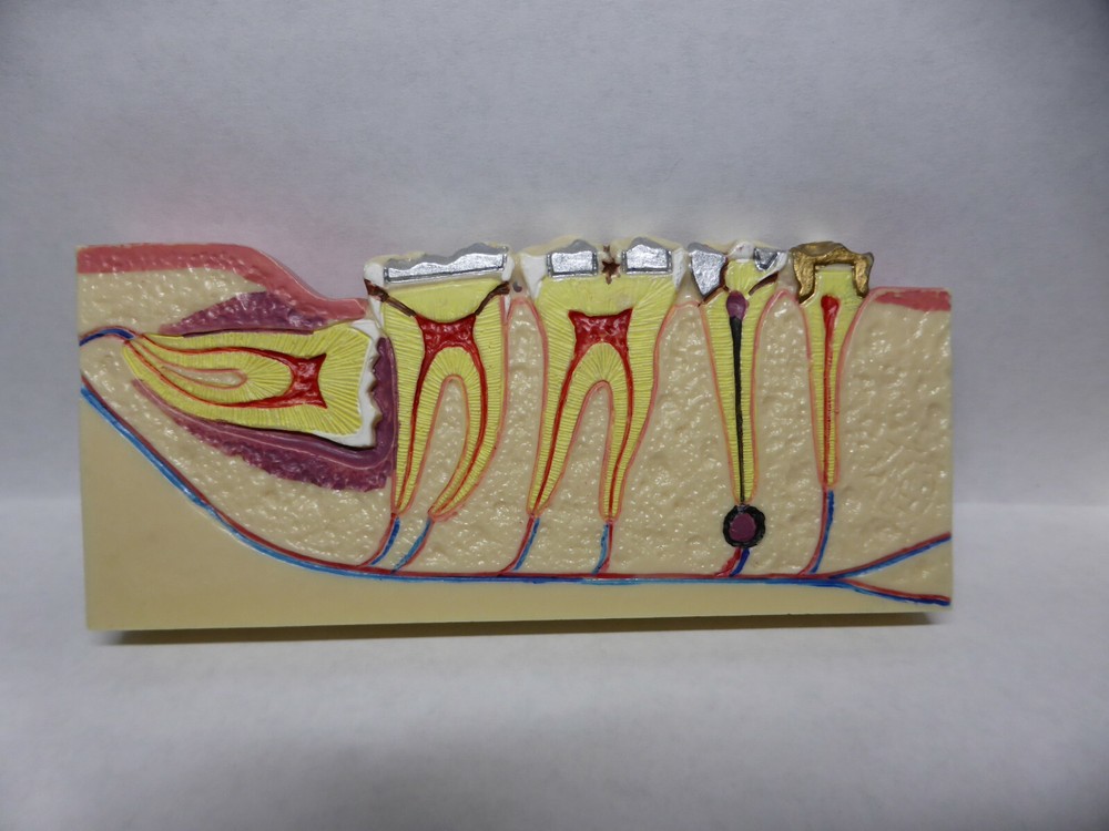 Typodont, Common Dental Pathologies Model, Patient instruction, x- section