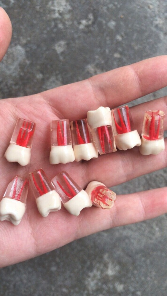 10x Dental clear Root Canal Teeth Study Practice Model Endodontic Pulp File