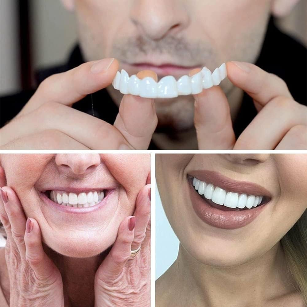 Top and Bottom Snap-On Fake Teeth Cover for Broken or Missing Teeth