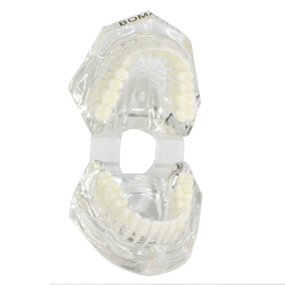 1×Yellow Transparent Plastic Study Teeth Model Demonstrate Comprehensive Repair