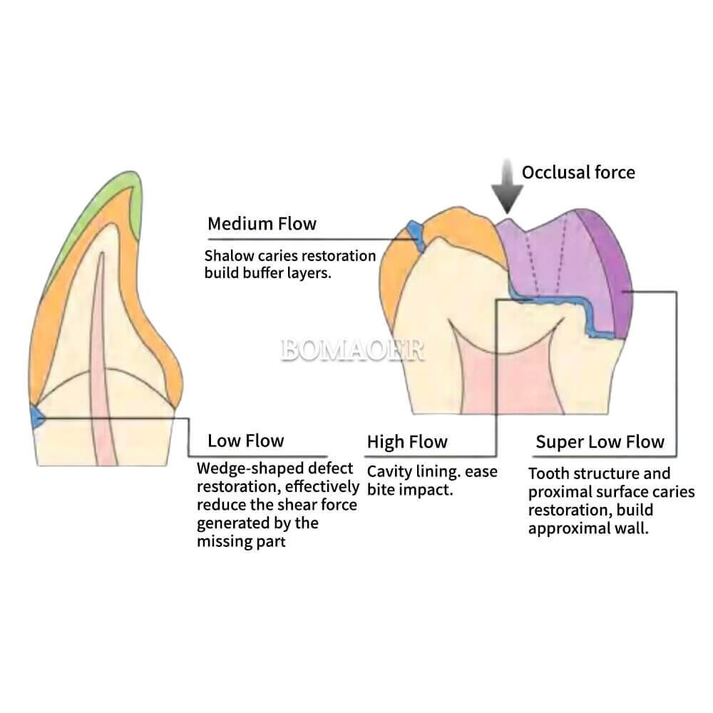 Dental Light curing Composite Flowable Resins Super Low Flow 3g/PC A3.5 Shade