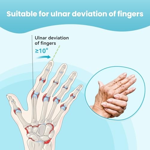Finger Ulnar Deviation Splint Brace, Finger Joint Deviation Right-M Black