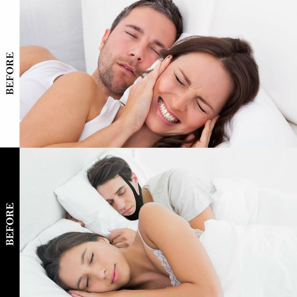 Anti Snore Chin Strap Solution, Snore Reducing Aids
