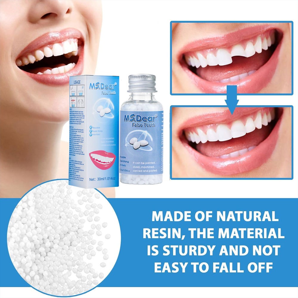 Moldable Teeth Beads Repair Kit - Temporary Fix for Missing, Broken or Gap Teeth