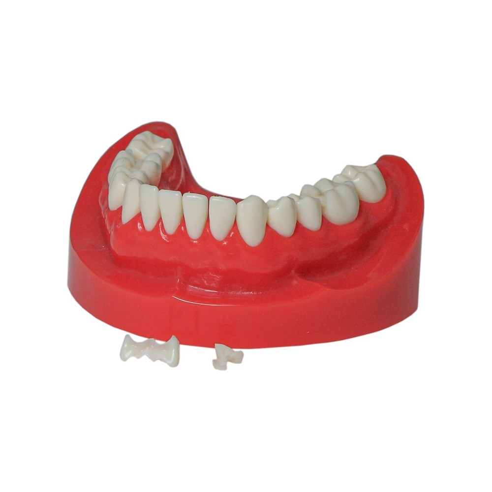 Dental M6004 Teaching Typodont Restoration Teeth Model Crown Post Core Bridge