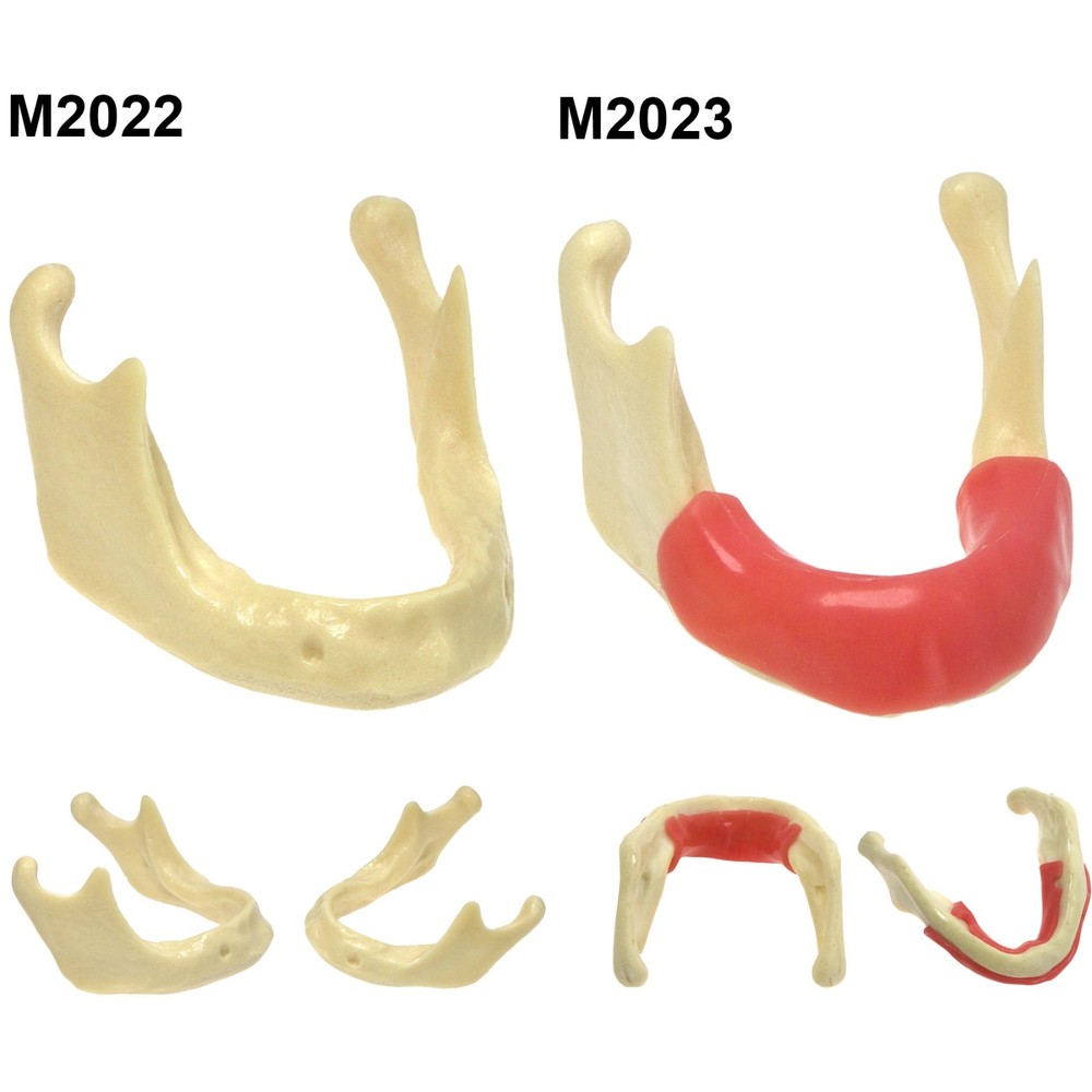 Dental Implant Jaw Bone Model For Practice Basic Drilling Insertion M2022/2023