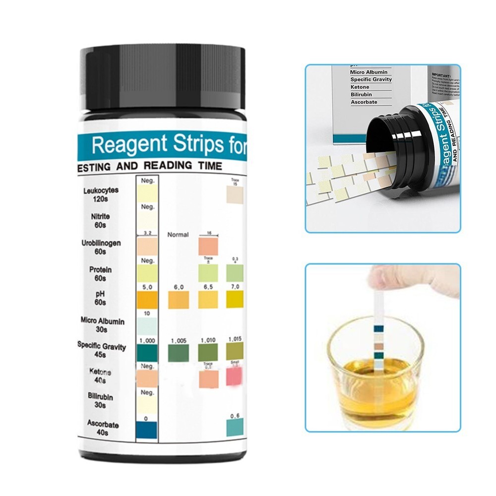 10 Parameter Generic Reagent Test Strips (100pcs/box) Ketone Glucose Home Use