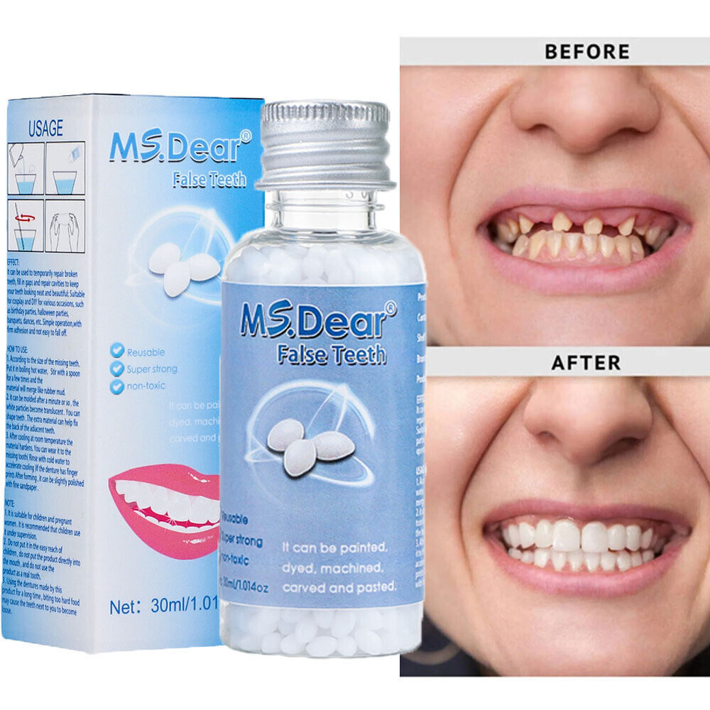 2× Resin False Teeth Solid Glue Temporary Tooth Gap Filler Tooth Repair Moldable