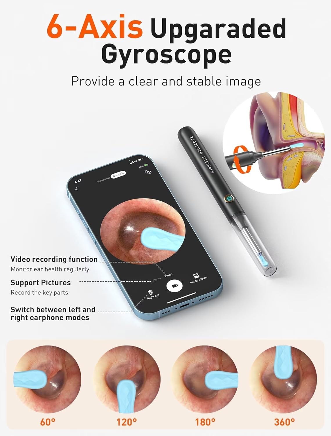 Ear Wax Removal Tool Camera - Ear Cleaner with 1080P HD Camera, FSA HSA Store El