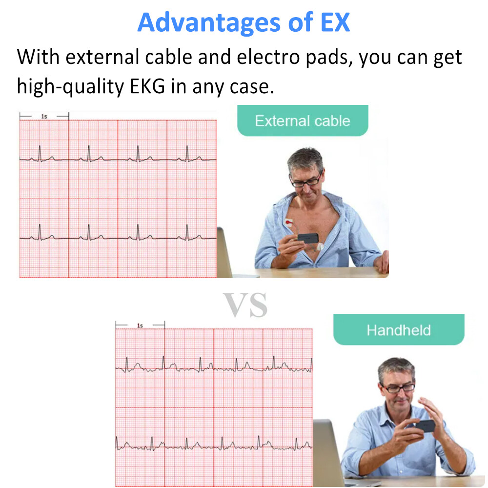 Touch Screen EKG Monitor Heart Monitor with ECG Cable AI-ECG Analysis via App