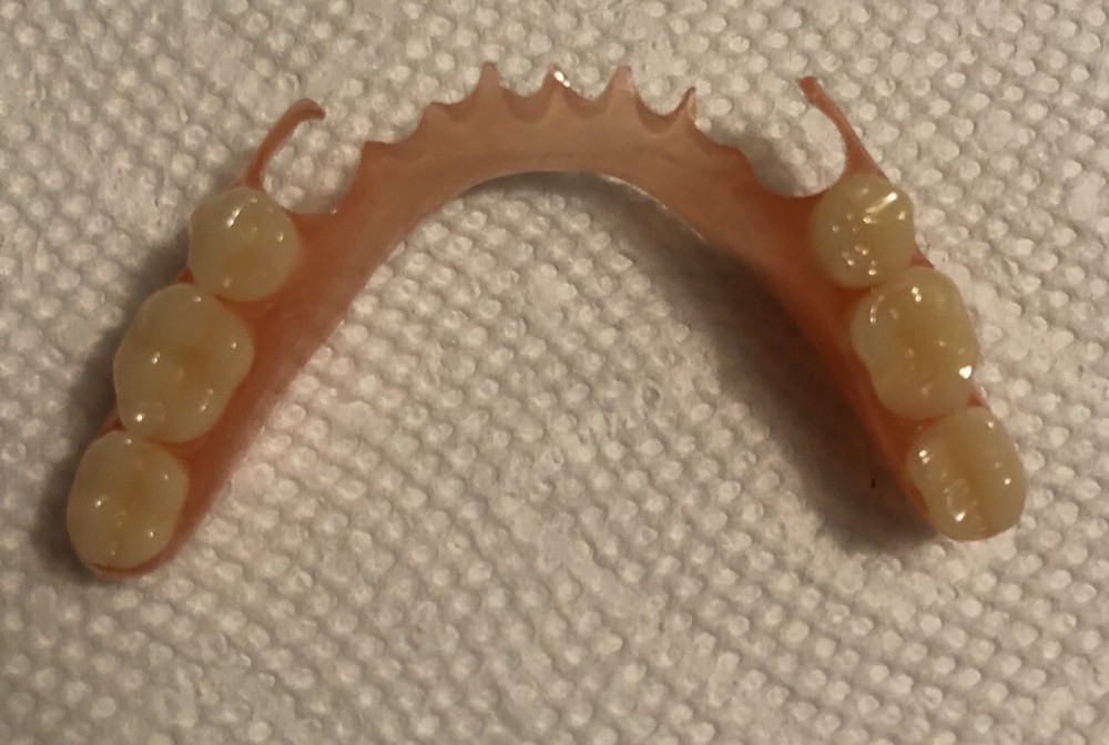 BURBANK Replacement DentalLab Partials Lower Side 6 teeth CustomMadeMissingTooth