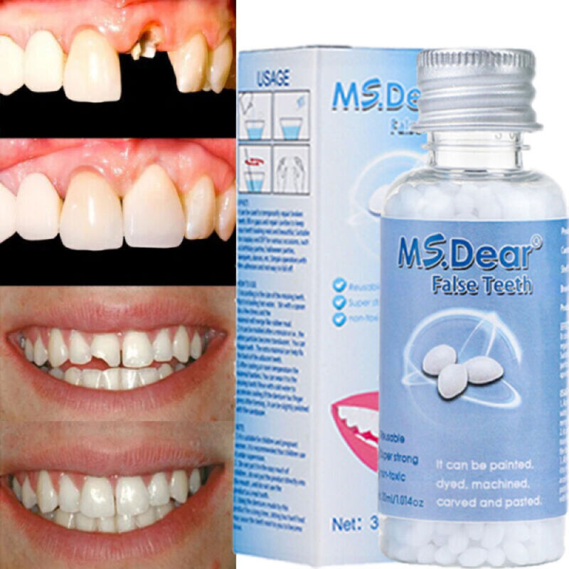 Teeth Repair Temporary Fix Kit Fitting Beads Reusable Fast Moldable False Tooth-