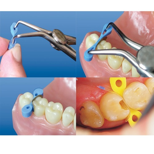 2 Boxes Dental Transparent Plastic Matrix Sectional Contoured Matrices 1.922