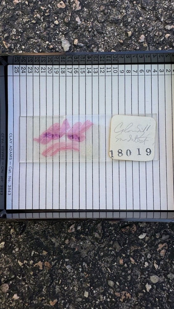 Microscope SLIDE Box VINTAGE Clay Adams With 25 Slides