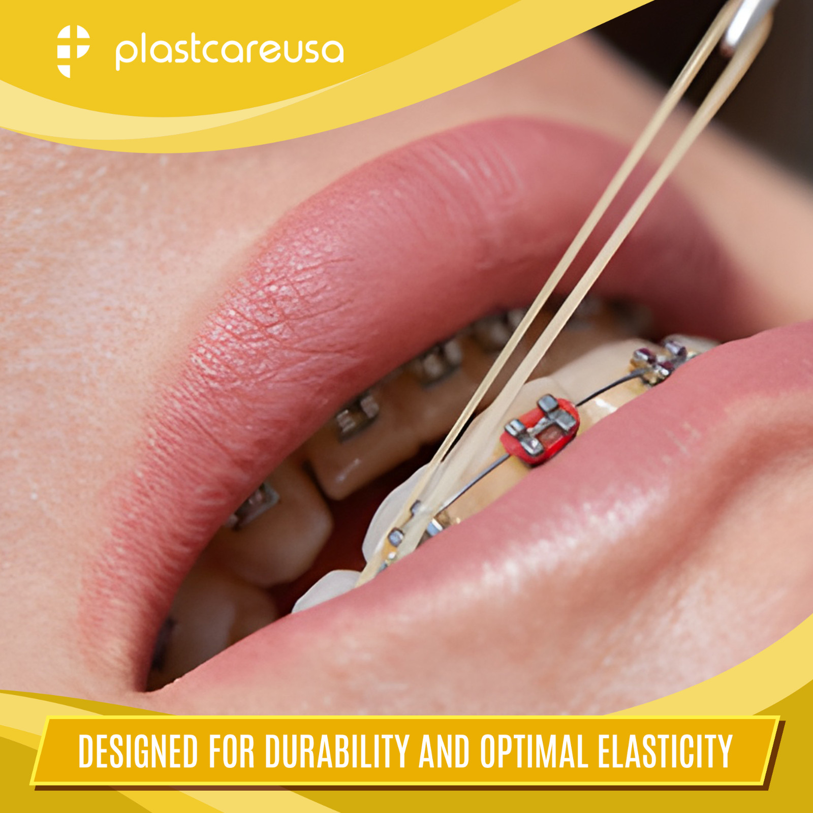 100 Medium 4.5 Oz 1/4" Fox Orthodontic Latex Elastic Rubber Bands Braces