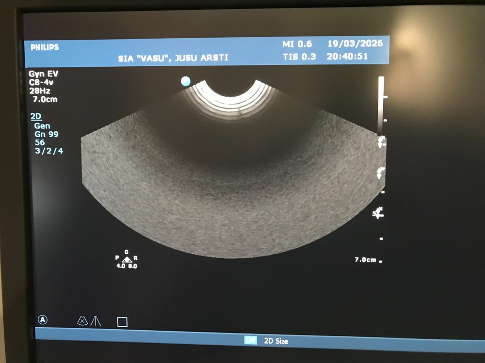 Philips C8-4v Ultrasound Transducer