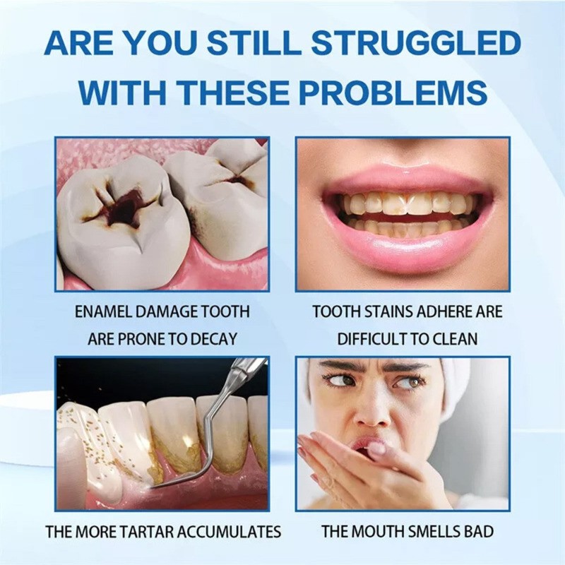 7.5% Hydroxyapatite Toothpaste Remove Yellow Tooth Stains For Sensitive Teeth