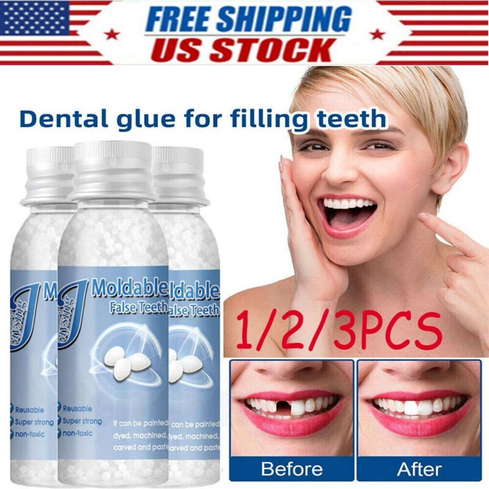 Tooth Repair Granules Temporary Kit Fitting Beads Reusable Moldable False Teeth