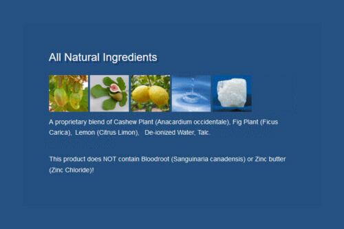 Mole Remover, Wart Remover, Skin Tag remover, Wart Mole Vanish™ Award Winning