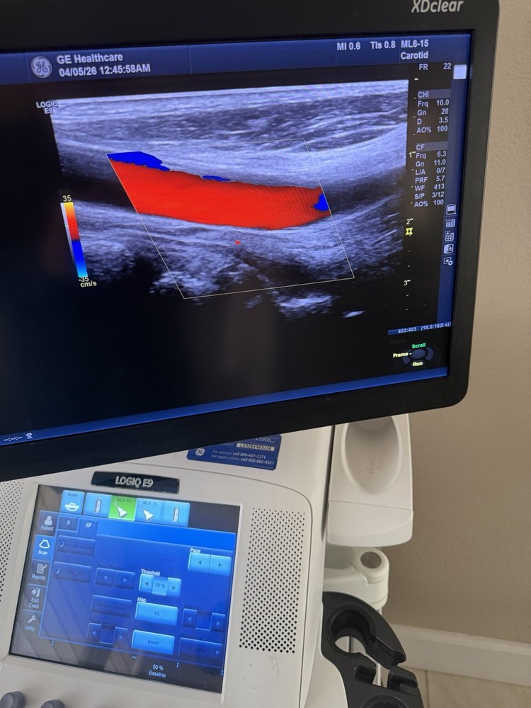 GE ML6-15 D Linear Vascular Probe , Excellent working condition,