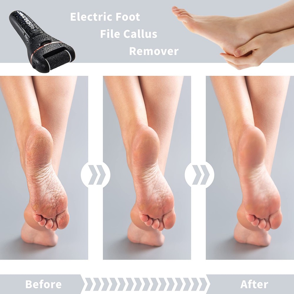 Electric callus remover test winner with3 replacement rollers to remove calluses
