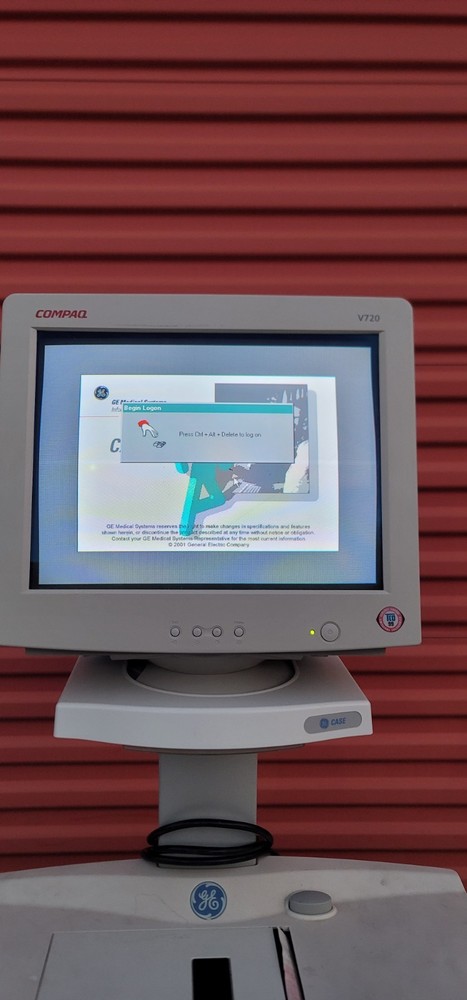 GE Case Stress Test System