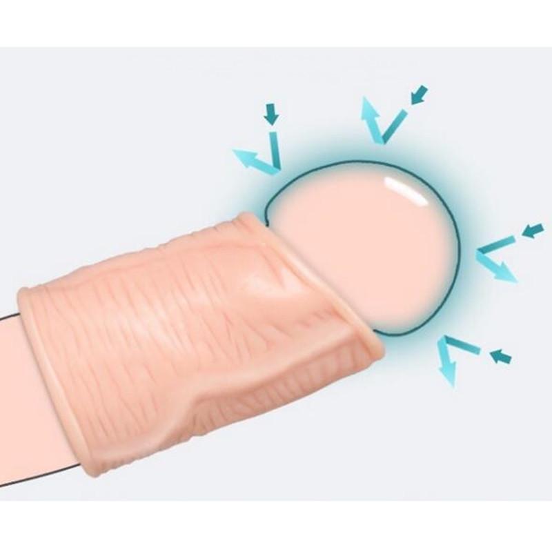 2PCS Penis Glans Foreskin Phimosis Curing Correction Ring For Man Supplement Kit