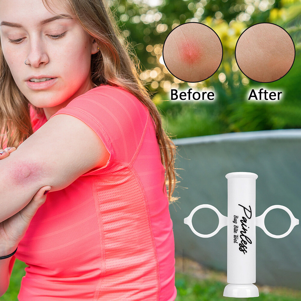 2x Vacuum Extractor Itch Relief Bee Sting Bug Bite Suction Tool Hiking Camping
