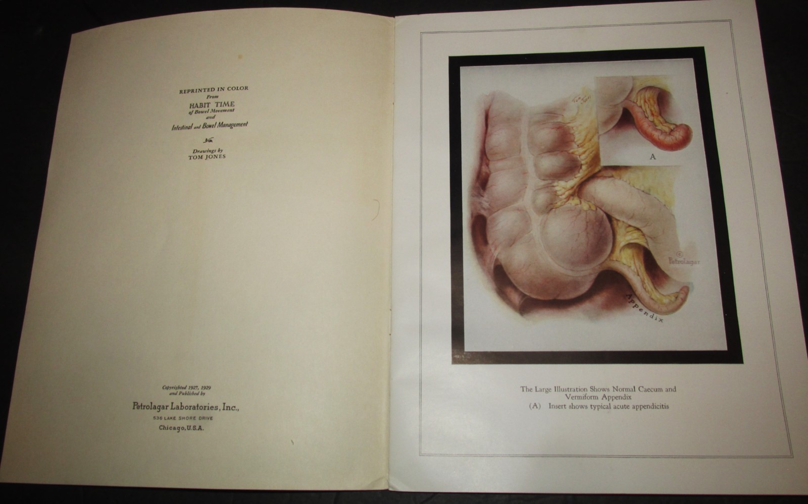 1929 Medical Booklet ILLUSTRATIONS OF THE LARGE BOWEL In Original Envelope