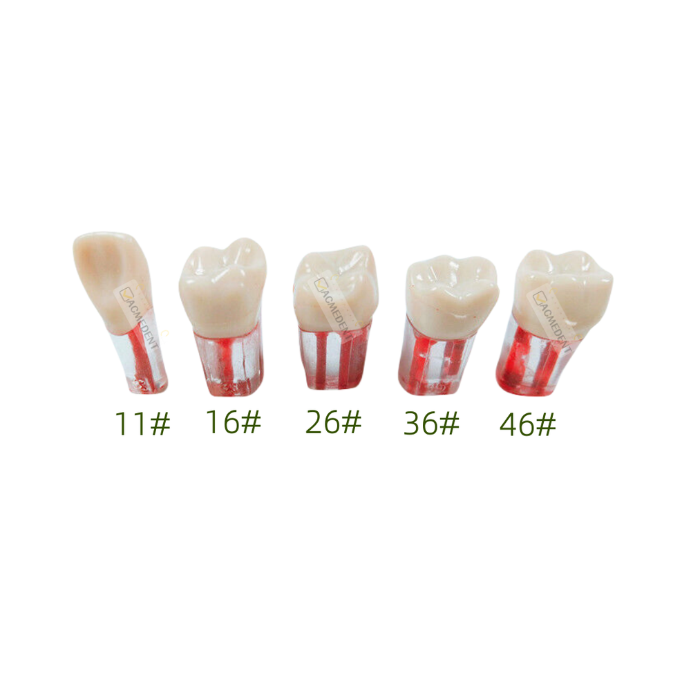 10Pcs Dental Root Canal Study Practice Model Red Pulp Files Molar Anterior Crown