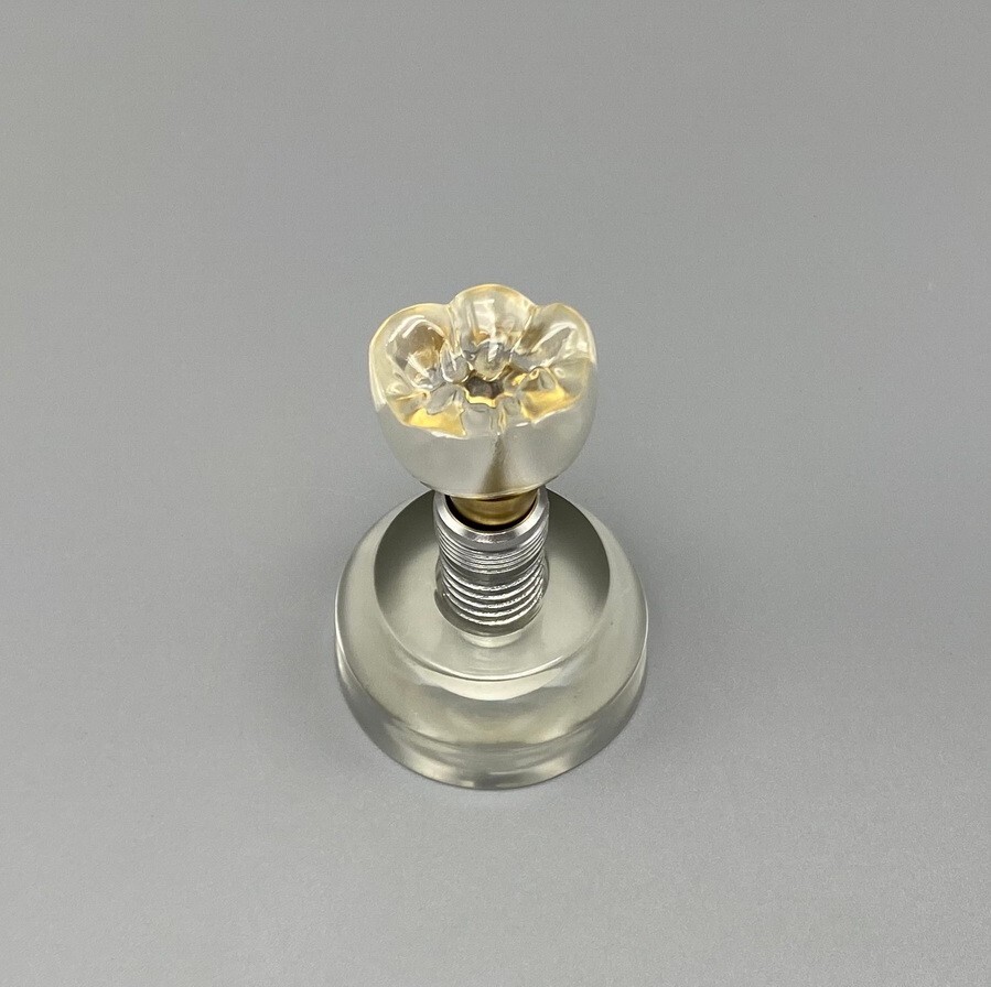 Dental Implant Teeth Model Detachable Abutment Crown Teaching Study Models Clear