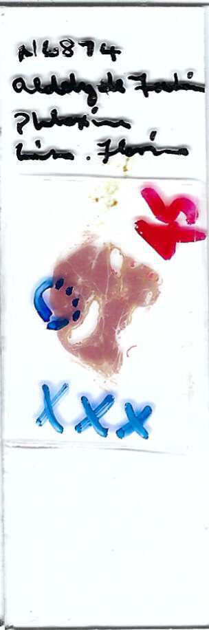 Human Islet Cell Hyperplasia Pathology Microscope Slide