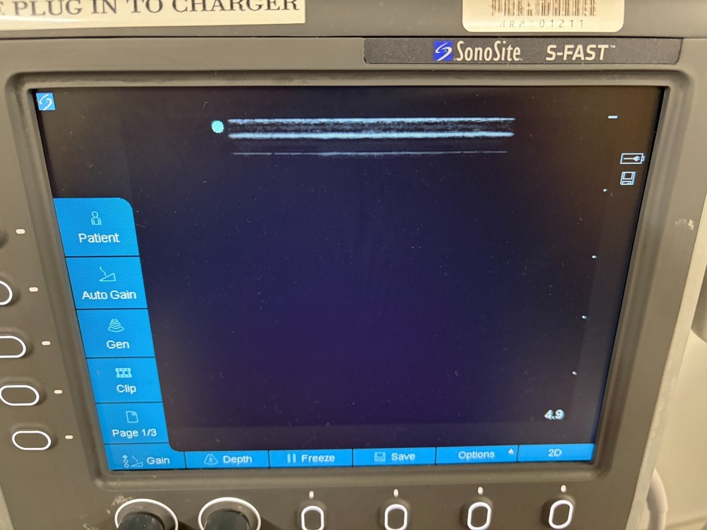 2014 SonoSite S-FAST Ultrasound System