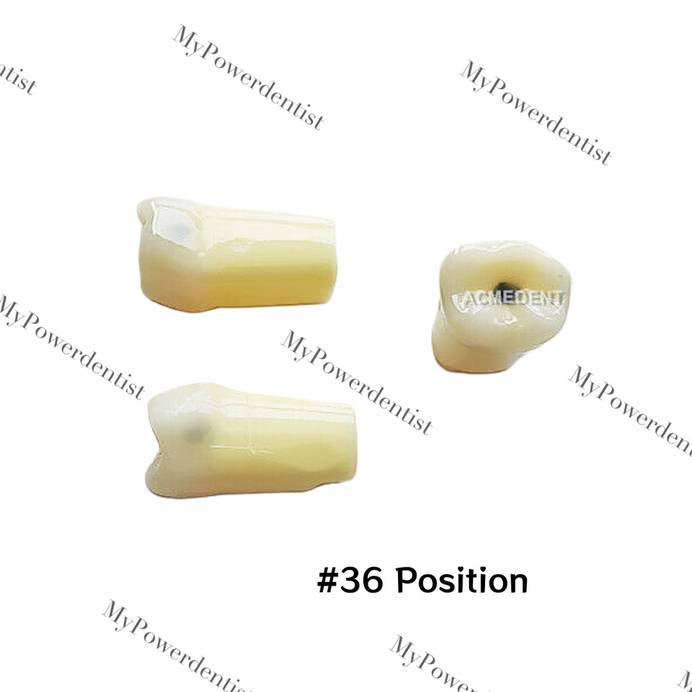 3Pcs/lot Dental Caries Tooth Practice Model Teaching Study Practise #36 Position