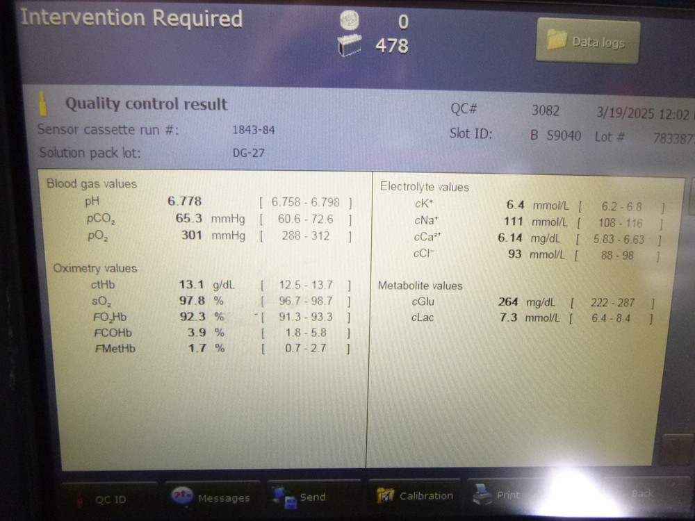 Radiometer ABL90 Flex Plus Blood Gas Analyzer ABL 90